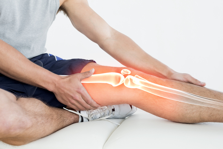 Plasma rico en factores de crecimiento para tratar la artrosis de rodilla