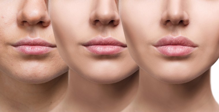radiofrecuencia facial piel y belleza