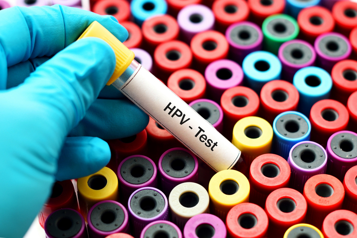 Consejos de salud para combatir las verrugas del VPH en casa