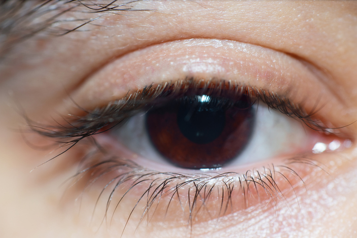 Qué es la ptosis palpebral y cuáles son sus principales tratamientos