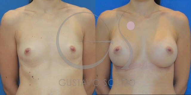 antes despues