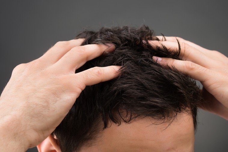 Combate la caída del pelo con la gama Pilexil de Farmacia 4 Estaciones