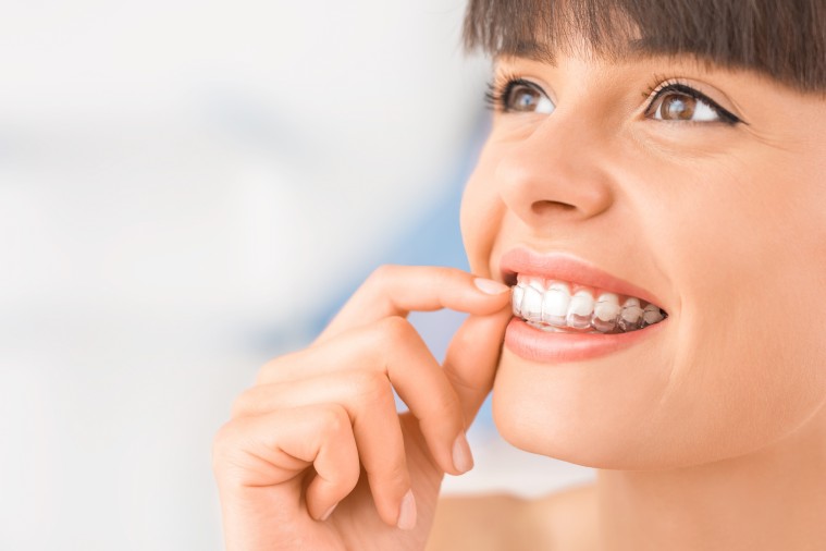 ¿En qué casos se usa la ortodoncia invisalign?