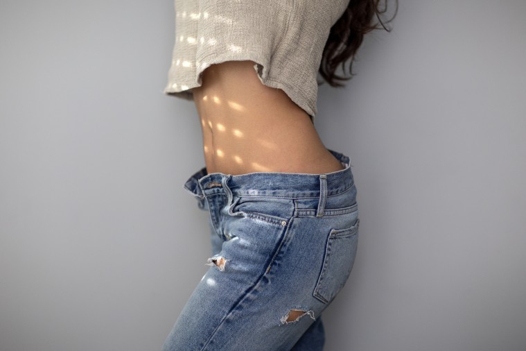 Cómo es el tratamiento Coolsculpting