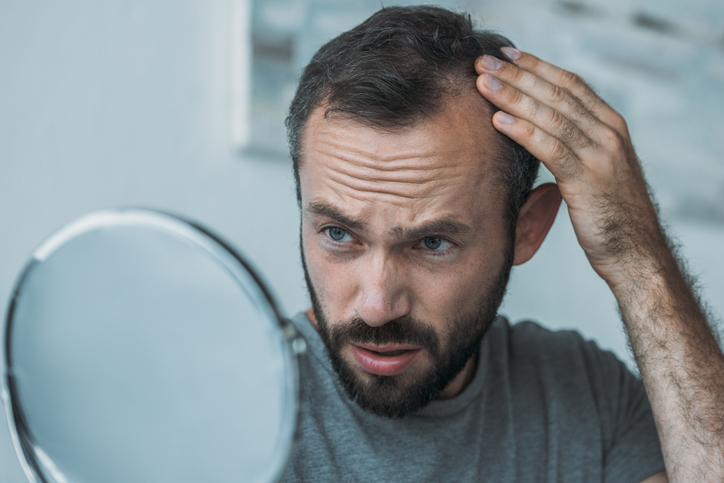Soluciones capilares para la caída del cabello