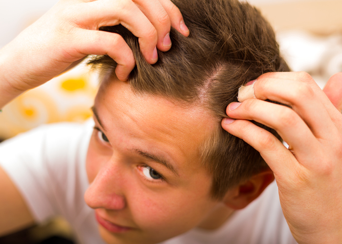 Conoce como el COVID afecta a la caída del cabello