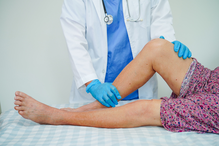 ¿Cómo mejorar la artrosis de rodilla?