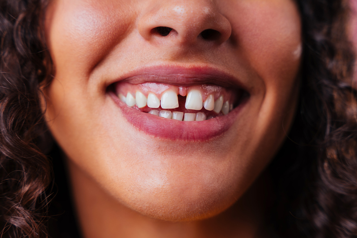 3 problemas de salud muy comunes que también afectan estéticamente a quienes los sufren