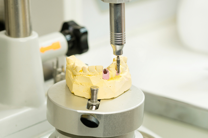 El material de endodoncia: Innovaciones para una odontología más eficaz